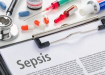 Penyebab Sepsis: Ancaman Kesehatan yang Mematikan