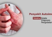 Menghadapi Autoimun: Strategi dan Kiat untuk Menjalani Hidup Sehat