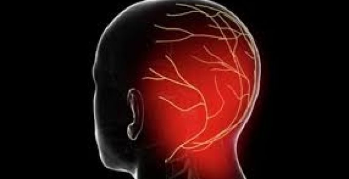 Sakit Kepala Belakang Parah? Kenali Neuralgia Oksipital